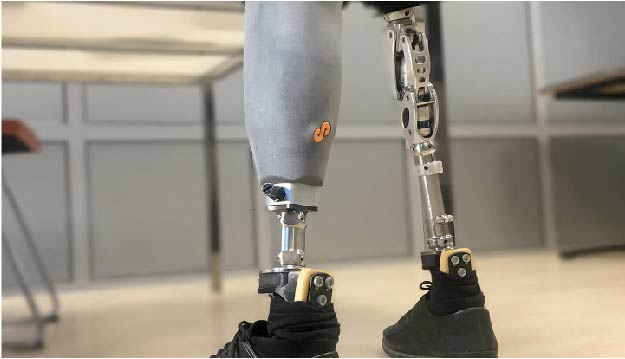 prosthetics_socket_3D-printing-02